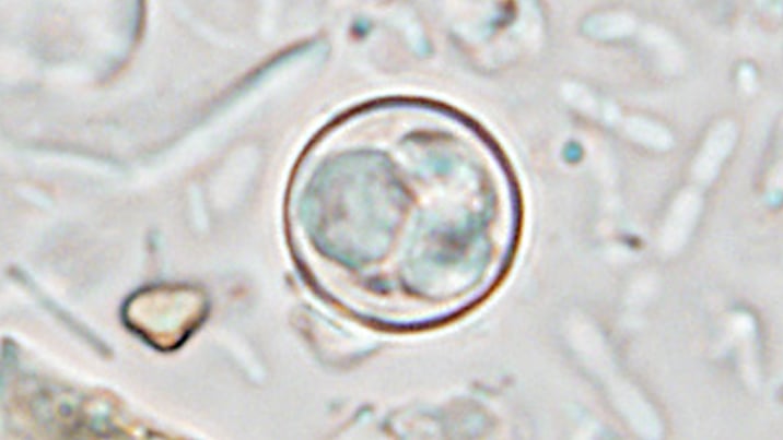 oocyst-cyclospora